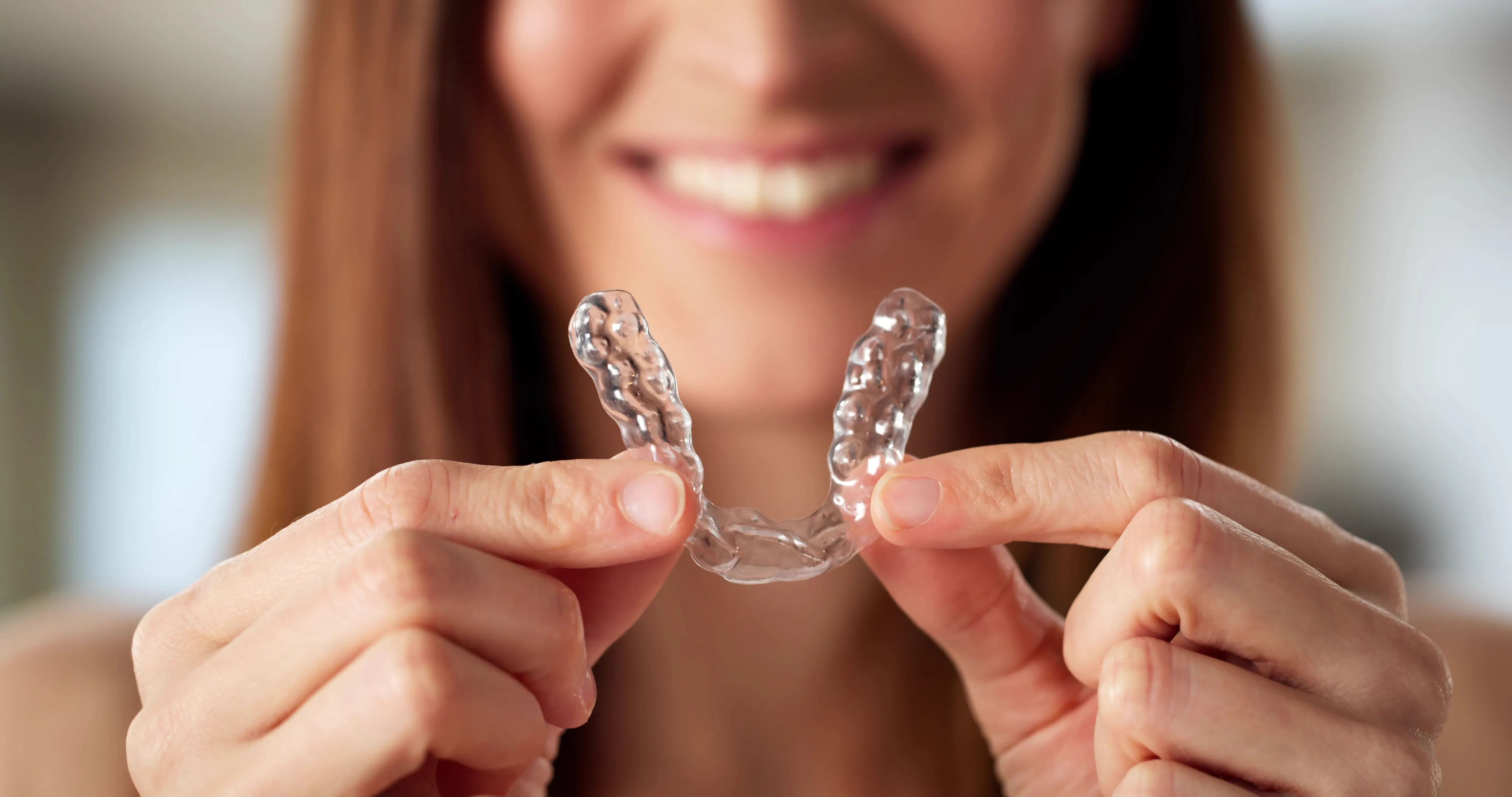 Clear Aligners