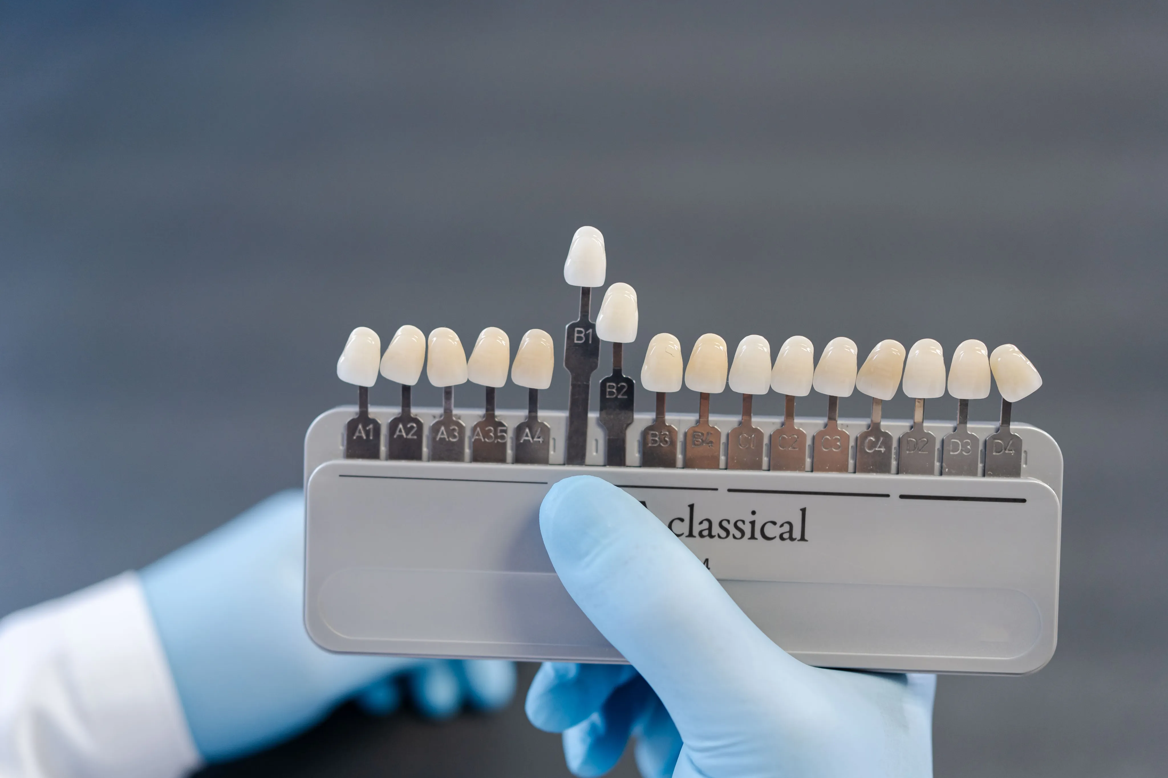 Dental Veneers